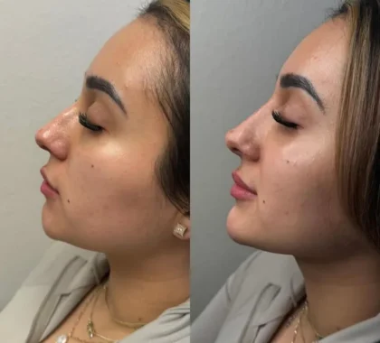 Facial Balancing